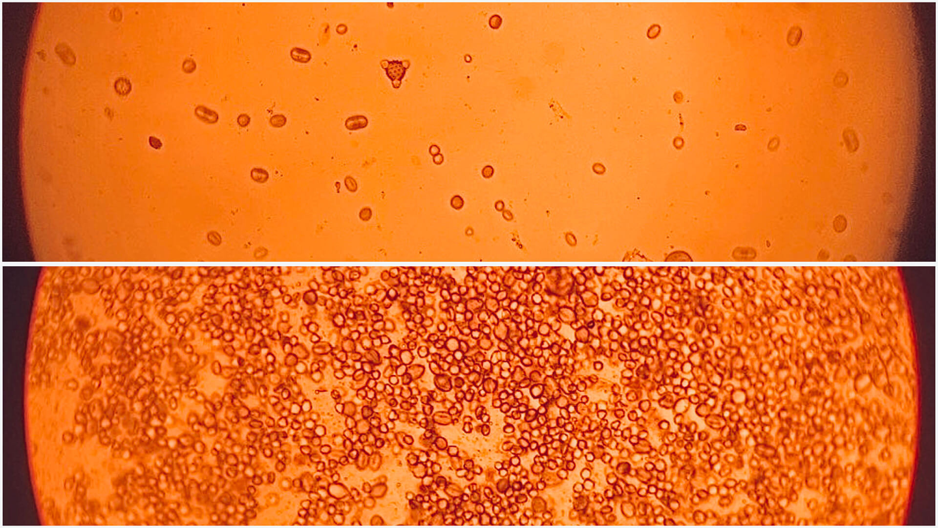 разликата между центрофугиран и пресован мед GHoney погледнати под микроскоп
